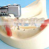 Typodont Orthodontic Model for Practicing Teeth Model Factory thumbnail-4