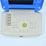 Portable Cattle Ultrasound Scanner thumbnail-5