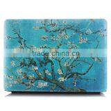Laptop Hard Shells Case Cover for Macbook Pro 15 thumbnail-1