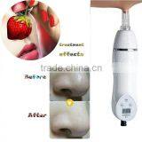 Mini Handheld Diamond Microdermabrasion Dermabrasion Vacuum Skin Peeling thumbnail-3