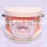 YIBISH Anti Snore Revolutionary Stop Snoring &sleep Apnea Mouthpiece Tongue Guard#ST001