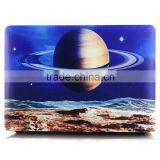 Full Body Laptop Skin Hard Equipment Case for Macbook A1181 Case Quality Choice thumbnail-1