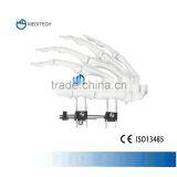 Orthofix Finger External Fixation Orthopedic Surgical Instruments Type C