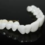 Dental PETG clip on veneers, snap-on-veneers, smile veneers, laboratoire dentaire, Dentallabor, laboratorio dental, dental laboratory, Shenzhen LJ dental lab China