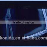 Agfa X-ray Film 14x17 Blue Medical Film 8x10in Made in Chinafilm for Hospital Agfa X-ray Film thumbnail-4