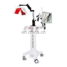 Diode Laser Hair Growth Hair Loss Treatment Machine Red Light Therapy With Scalp Hair Follicle Detection Beauty Equipment thumbnail-4