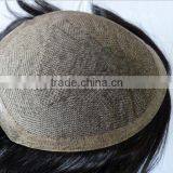 Replacement thumbnail-1