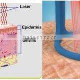 Rf Fractional Needle/rf Excited Co2 Fractional Laser/fractional rf thumbnail-4