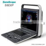 Hot Medical 4d Portable Color Ultrasound Sonoscape S8exp
