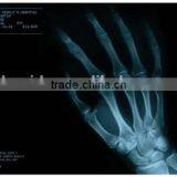 Medical X-ray Film /fuji Printing Clear Image Medical Dry Film With Factory Price thumbnail-5