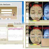 Newest Skin Health Analysis Machine/portable Hair and Skin Analyser Equipment thumbnail-5