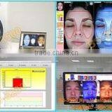 Brand New Model Skin Analyzer / Visia Skin Analysis Machine / Hot Sale Skin Scanner BS-1200/1200P thumbnail-6