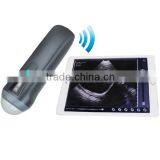 UProbe-1 Wireless Probe Ultrasound Scanner thumbnail-1