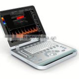 2016 color doppler ultrasound for human with laptop