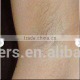 Intense Pulse Light Professional Shr Elight Hair Removal Machine Laser Hair Removal CE Approved thumbnail-6