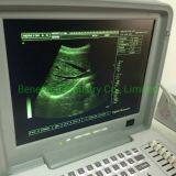 Portable B/W Ultrasound Scanner With High Quality thumbnail-2