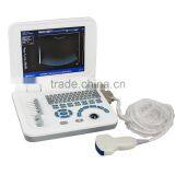 CE Laptop Ultrasound Machine With Multi Frequency Probe Ultrasonic Diagnostic System RUS-9000F2 thumbnail-2