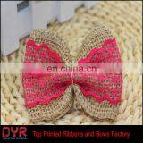 Blue Lace Jute Burlap Ribbon Bow thumbnail-2