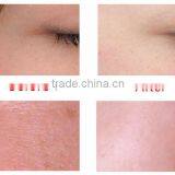 Face Peeling Machine Water Oxygen Jet Peel Machine Water Facial Peeling Best Oxygen Facial Machine CE Certification thumbnail-4