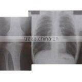 Konida Imagers x ra Blue Sensitive Films Medical Thermal Film China Film thumbnail-5