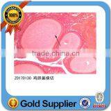 Tooth Prepared Slides/tooth Pathology Slides/human Tooth Slides