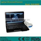 CE Approved Laptop Ultrasound Scanner/Ultrasound Machine With 3.5Mhz Multi-frequency Convex Probe RUS-9000F thumbnail-1