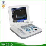 OEM Factory 10.4 Inch TFT Color LCD Laptop Portable Ultrasound Machine for Pregnancy thumbnail-1