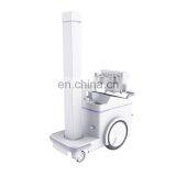 MY-D049V Hospital Device 500mA Digital Mobile Radiography System Medical x Ray Machine Price X-ray Scanner thumbnail-2
