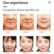 2 in 1 Ice Sculpture Facial Lifting Wrinkles Removal Skin Tightening Device for Salon thumbnail-4