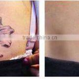 2016 Advanced Portable nd Yag Laser Tattoo Removal thumbnail-3