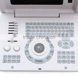 Factory Price!!CE Approved Notebook/Portable Ultrasound Scanner With 3.5Mhz Multi-frequency Convex Probe RUS-6000D thumbnail-2
