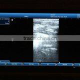 2015 New Laptop Ultrasound Scanner (PC System) on Sale thumbnail-4