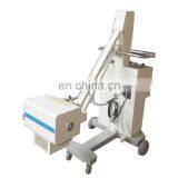 MY-D049V Hospital Device 500mA Digital Mobile Radiography System Medical x Ray Machine Price X-ray Scanner thumbnail-3