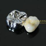 Full Metal Crown, FMC, FGC, Full Metal Post Core, Dental Crown, Cast Metal Crown, Dental Prosthesis, Laboratorio Dental, Dental Laboratory, Dentallabor, LJ Dental Lab China thumbnail-3