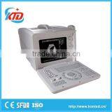 CRT display low price ultrasound machine for wholesales