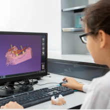 Dental Implants China Dental Lab | Dental Lab Outsourcing Service thumbnail-3