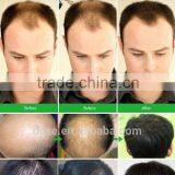Grey Hair Thickening Fiber With Private Label of Hair Thickener Spray thumbnail-4
