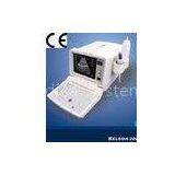Ultrasound Scanner BELSON 200C With CE Certificate