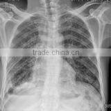 Konida X-ray Automatic Medical Film Processor Agfa Laser Film thumbnail-1