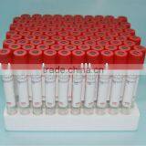 Red Disposable Vacuum Blood Pro-coagulation Tube thumbnail-1