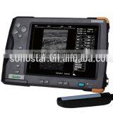 Sonostar Portable Cow Ultrasound Machine Pig Pregnancy Ultrasound Scanner Pirce V5 thumbnail-5