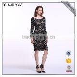 Elegant Short Straight Black Crochet Dress,black Short Dress thumbnail-2