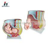 Human Pregnant Uterus