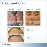 Portable Oxygen Facial Machine For Skin Rejuvenation Skin Whitening Mini Oxy Skin Oxygen Jet Diamond Dermabrasion thumbnail-5