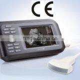CE Certificated Palm Ultrasound Scanner HandScan H8 With Convex Linear Transvaginal Micro-convex Probe thumbnail-1