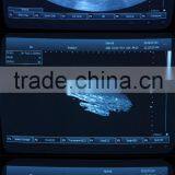 Beautiful Compact Diagnostic Ultrasound Probe / Mini Ultrasound Machine / Portable Ultrasound Scanner thumbnail-6