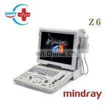Popular Trolley Scanner Mindray / z6 Mindray /buy Ultrasound Scanner for Hospital thumbnail-3