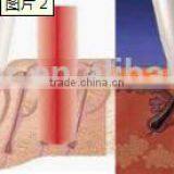 Laser Diode Hair Removal Lead a Permanet Effect /808nm Diode Laser Hair Remover thumbnail-4