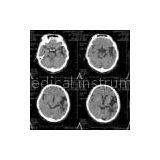 8in * 10in Scratch-resistant Medical Laser Imaging Film For Konida Laser Printer thumbnail-1