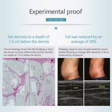 Trusculpt Id and Flex Inmode Tite Body Slimming Double Chin Cutera Evolve Tite Bipolar Rf Slimming 3d Trusculpt Id thumbnail-6